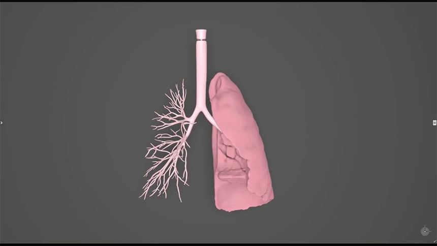 lung 3d model